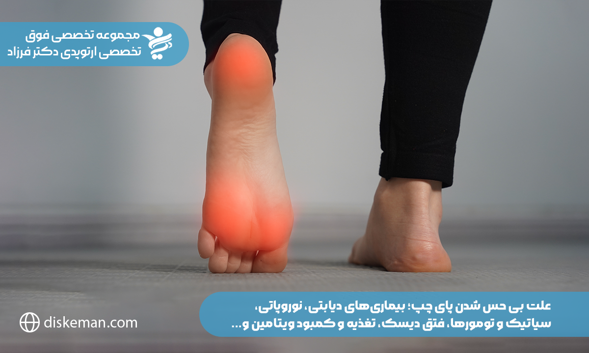 علت بی حس شدن پای چپ؛ بیماریهای دیابتی، نوروپاتی، سیاتیک و تومورها، فتق دیسک، تغذیه و کمبود ویتامین و...